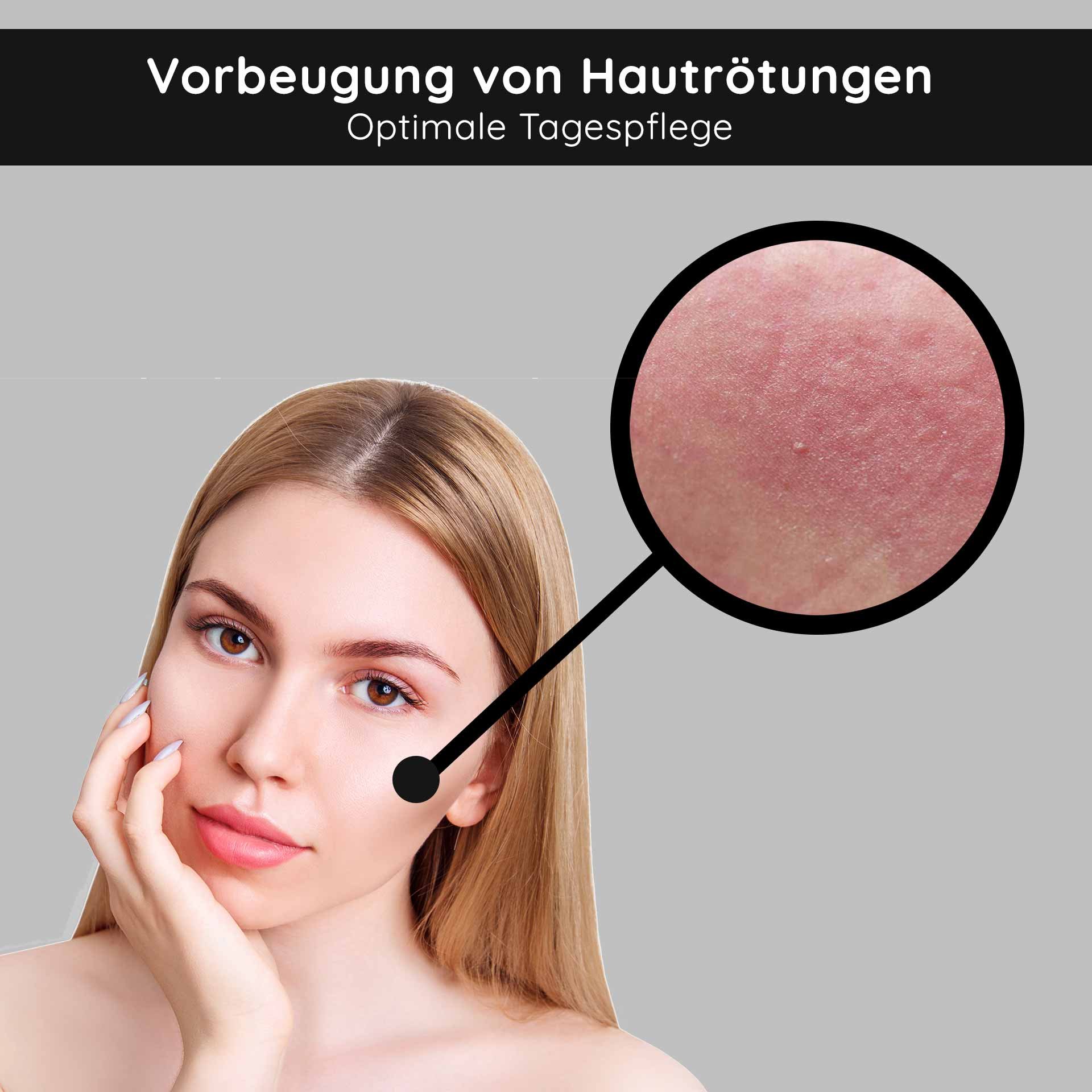 Femme à la peau lisse et longs cheveux blonds, montrant des rougeurs cutanées dans une zone agrandie, soulignant un soin de jour optimal pour la prévention des problèmes de peau.