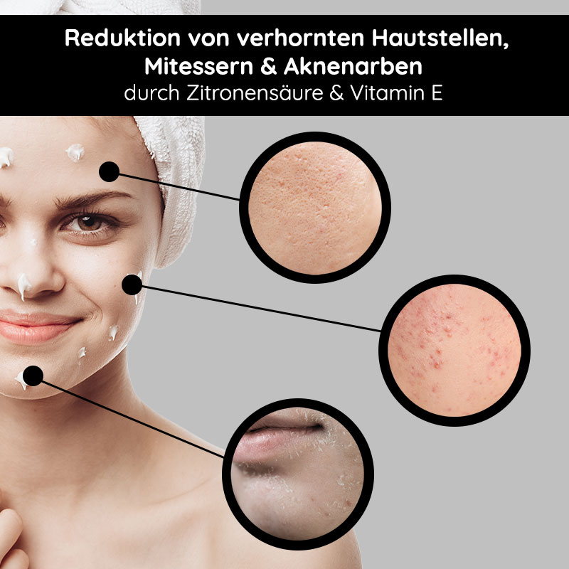 White Tea Silk Mask 200 ml Crème riche & masque Frau mit Gesichtsmaske, die Hautpflege und Reduktion von Mitessern und Aknenarben durch Zitronensäure und Vitamin E zeigt, mit Hautvergrößerungen zur Veranschaulichung der Ergebnisse.