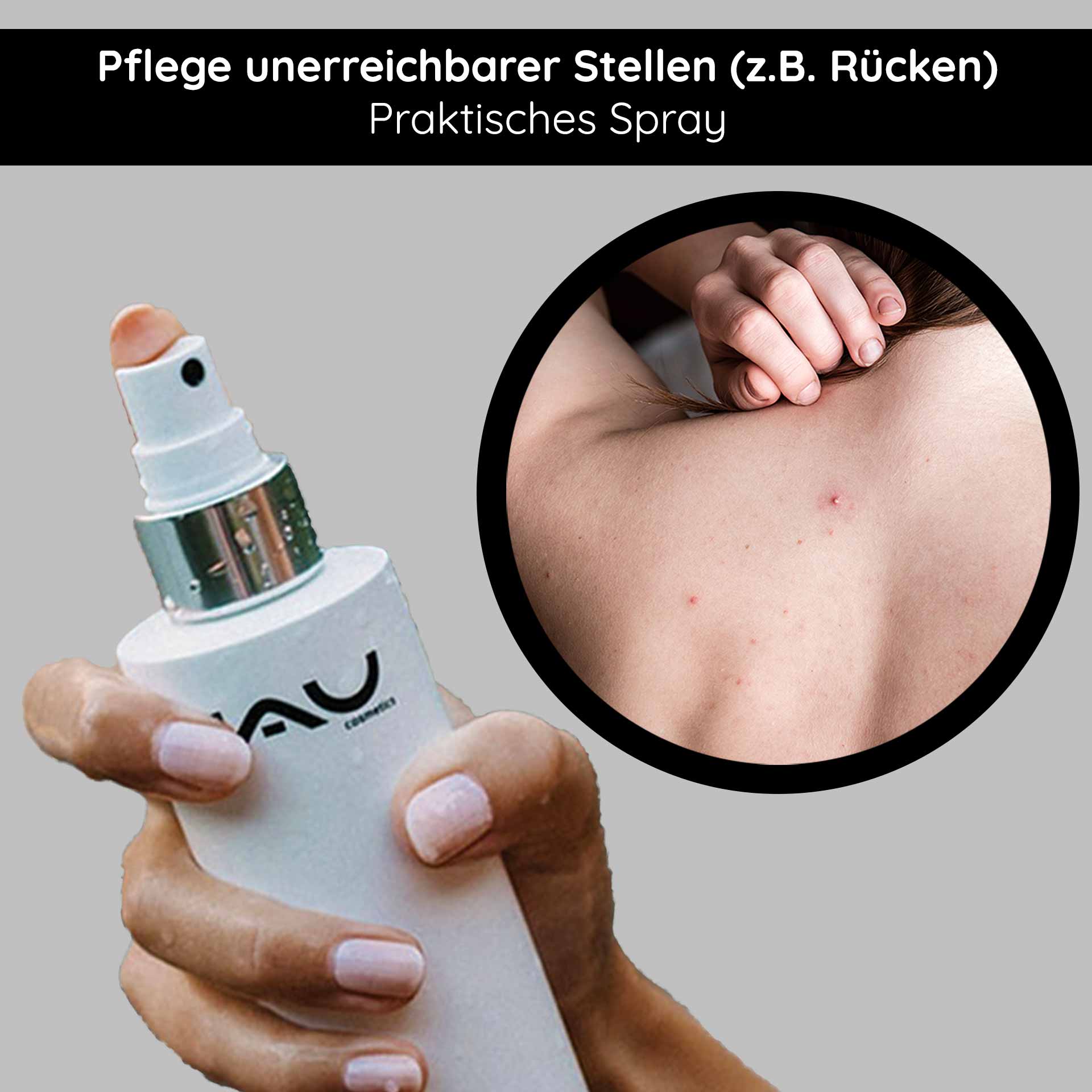Silver Face & Body Spray 200 ml avec panthénol & micro-argent Halten Sie das RAU Cosmetics Silver Face & Body Spray in der Hand, das für die Behandlung schwer erreichbarer Bereiche wie dem Rücken entwickelt wurde und Vorteile bei Hautirritationen und Akne bietet.
