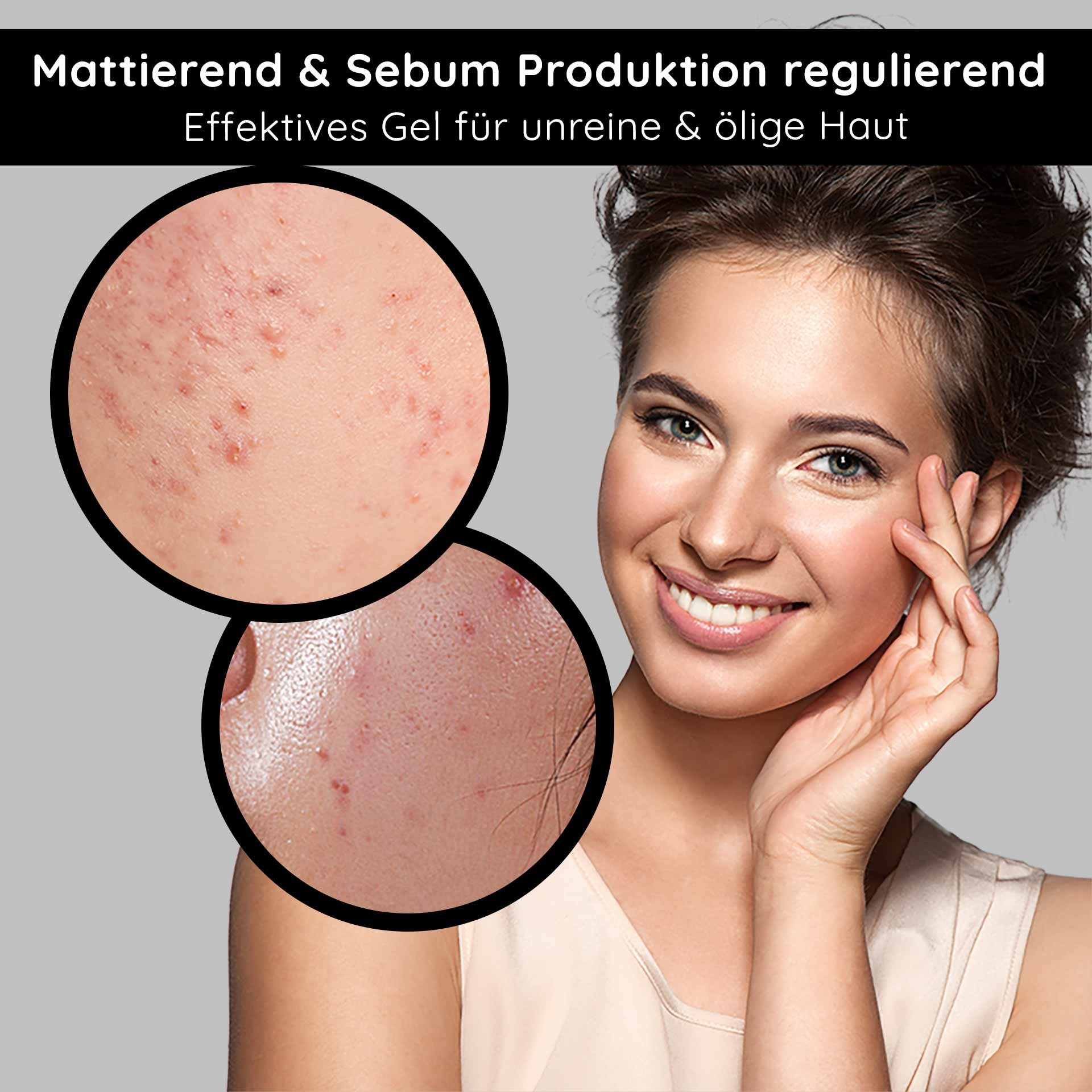 Gel matifiant pour peaux impures et grasses, pores de la peau avec imperfections, femme souriante à la peau saine, focus sur le soin de la peau et la régulation du sébum.