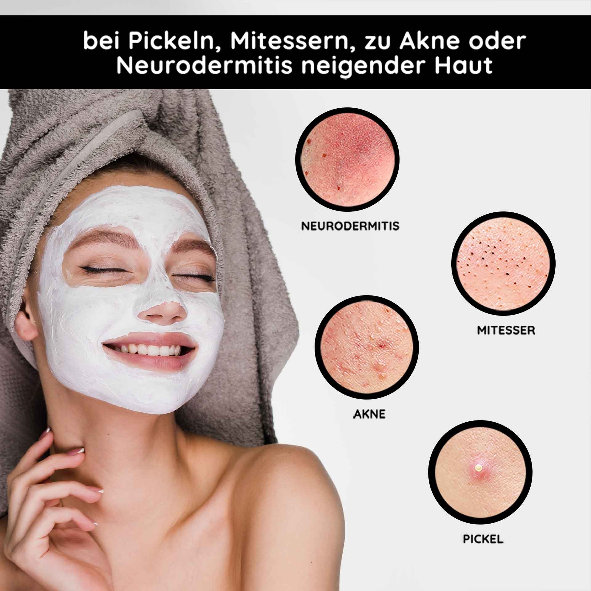 Femme souriante avec un masque facial pour le soin de la peau, entourée d'images de problèmes cutanés tels que l'acné, les points noirs et la neurodermite, présentant les bienfaits du Mineral Mask de RAU Cosmetics pour les peaux à problèmes.