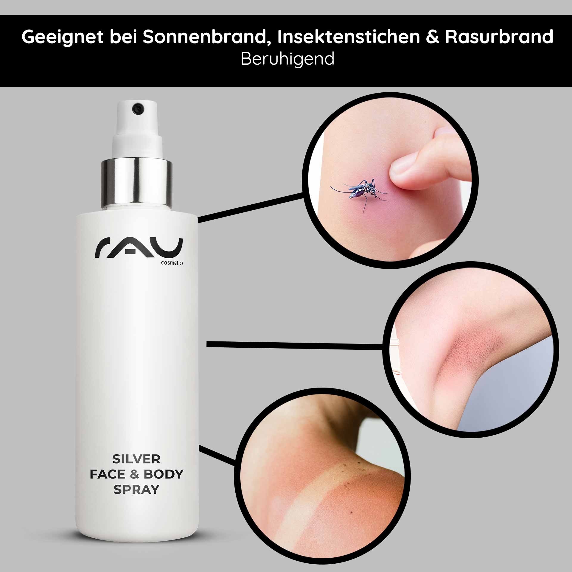 Silver Face & Body Spray 200 ml avec panthénol & micro-argent Silver Face & Body Spray von RAU Cosmetics, geeignet zur Linderung von Sonnenbrand, Insektenstichen und Rasurbrand, mit sichtbaren Beispielen für Hautirritationen und einem eleganten Sprühflaschendesign.