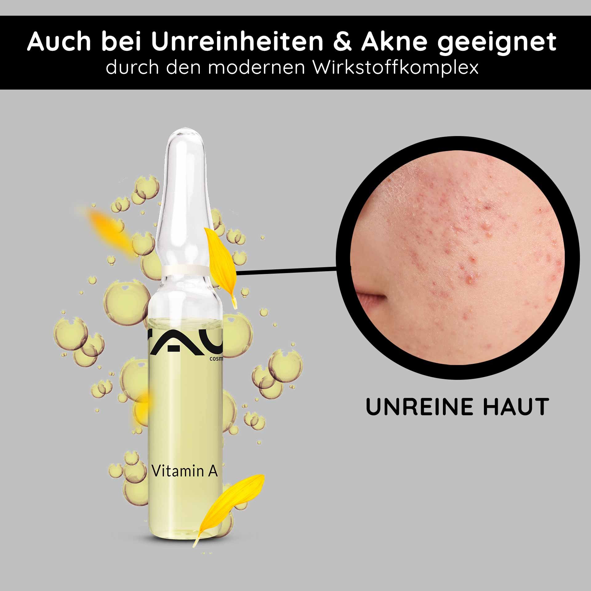 Ampoule à la vitamine A de RAU Cosmetics, entourée de bulles, mise en avant pour le traitement des peaux à imperfections et de l'acné, avec le texte « PEAUX À IMPERFECTIONS » et des pétales jaunes.