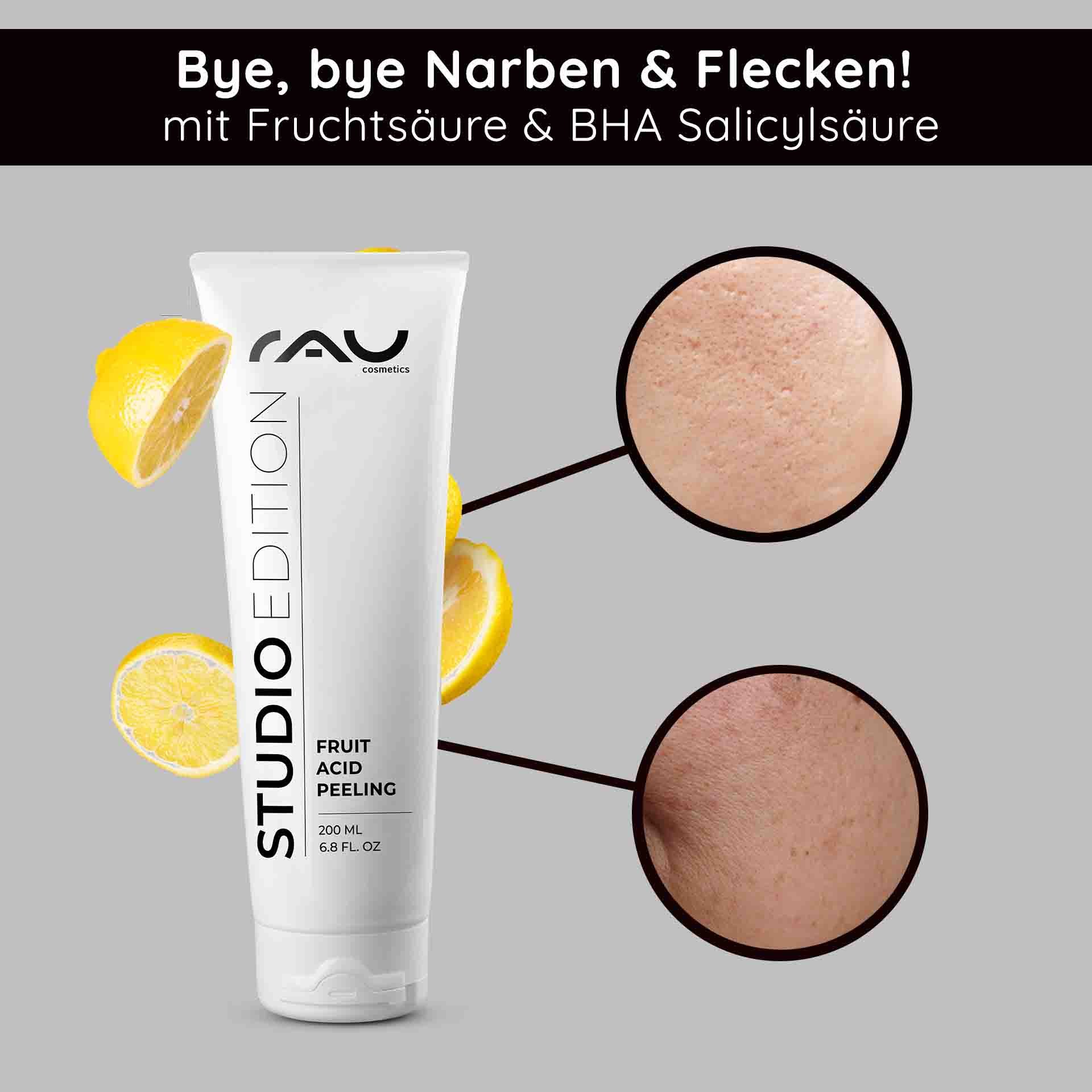 Tube de Fruit Acid Peeling de RAU Cosmetics avec des rondelles de citron, soulignant l'amélioration de la structure de la peau et les bienfaits de l'acide salicylique BHA pour réduire les cicatrices et les imperfections.