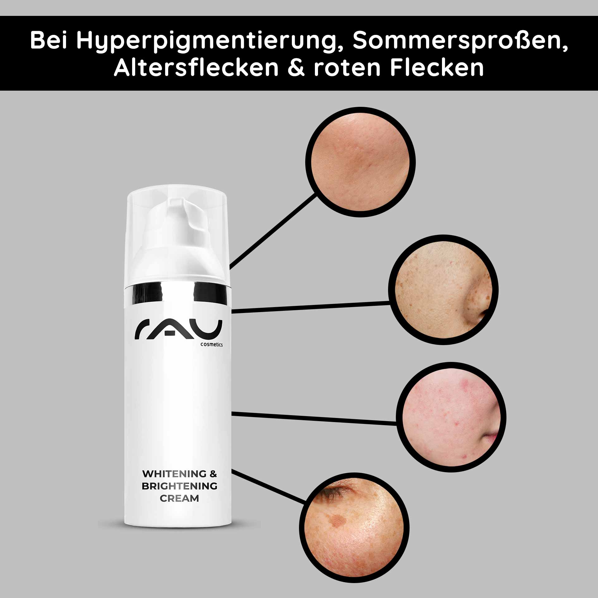 Whitening & Brightening Cream 50 ml Éclaircissant pour la peau Die Whitening & Brightening Cream von RAU Cosmetics hebt Hautunreinheiten wie Hyperpigmentierung, Altersflecken und rote Flecken hervor und zeigt wirksame Lösungen zur Hautaufhellung.